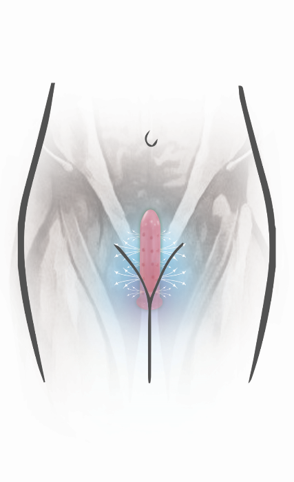 Size 7 Neodymium Magnetic  Vuvatech   Vaginal Dilators 